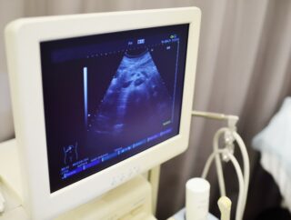 Bezpieczeństwo USG w czasie ciąży – co należy wiedzieć